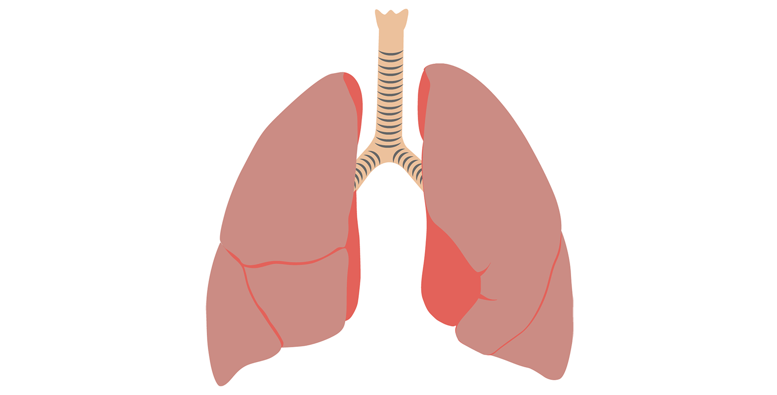 Sophion ion channels and cystic fibrosis